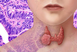 HYPOTHYROIDISM | Drsafehands 