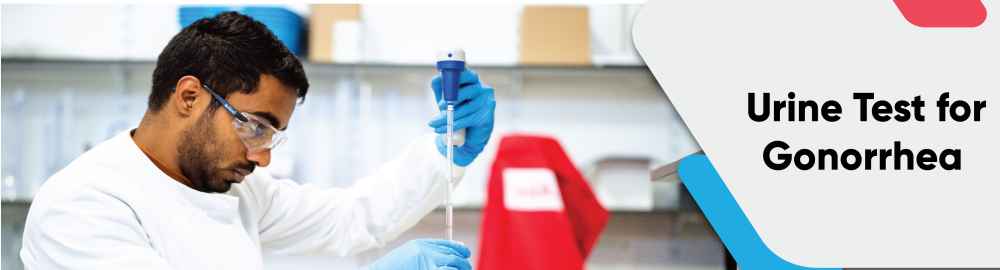 Urine Test for Gonorrhea Test